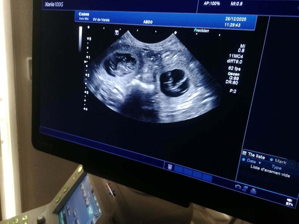 Chiots à naître toute fin janvier 